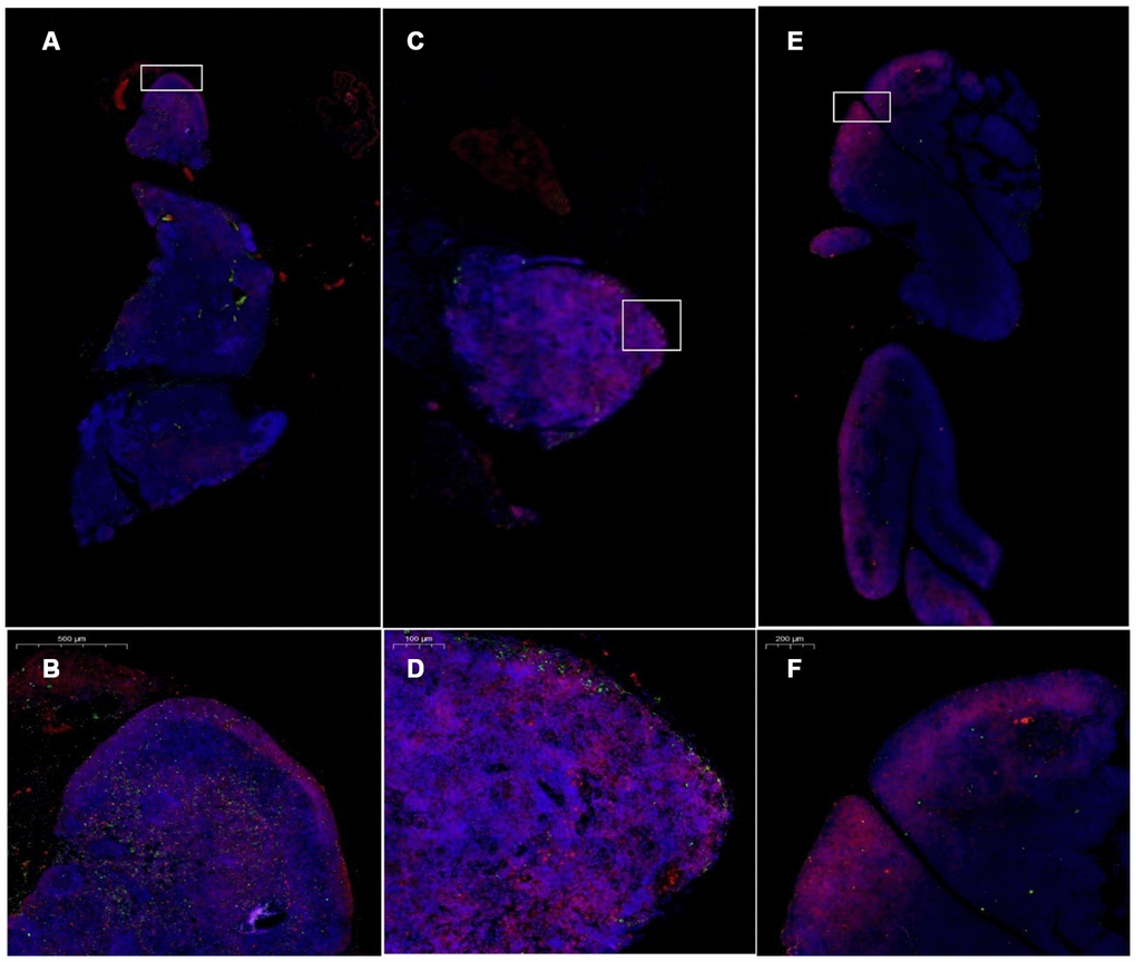 Changes in CK5 and CK8 expression in the thymus after treatment with mUCMSCs. Note: (A, B) are immunofluorescence staining images of thymus tissue in mice treated with mUCMSCs for 1 month; (C, D) are immunofluorescence staining images of mouse thymus tissue from the model control group; (E, F) show the thymus in the young control group. Immunofluorescence staining map. CK5 is red, and CK8 is green. Note: *** indicates p  0.05. Cytokeratin 8 (cK8) and cytokeratin 5 (cK5) are markers of the thymic cortex and medulla, respectively, as shown by the results of thymic staining with immunofluorescent antibodies.