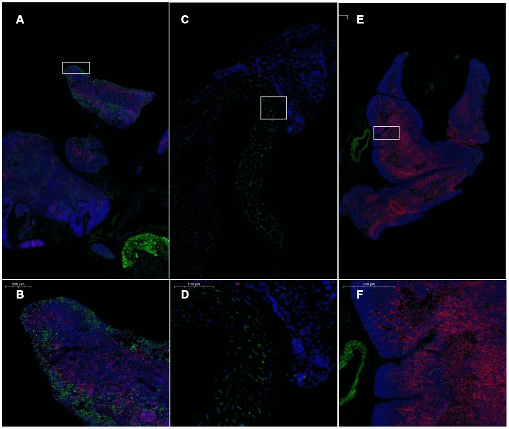 Pathological morphology of the thymus after transplantation of umbilical cord mesenchymal stem cells. Note: (A, B) show immunofluorescence staining of thymus tissue CD4 and CD8 cells in the treatment group. (C, D) show immunofluorescence staining of CD4 and CD8 cells in the thymus tissue of model control mice. (E, F) show immunofluorescence staining of CD4 and CD8 cells in the thymus tissue of young control mice. CD4 is red, and CD8 is green. The number of CD4+ and CD8+ cells in the thymus of the model control mice was small.