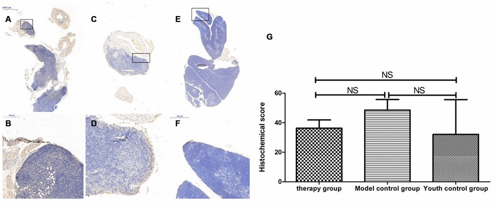 Differences in P53 expression in mouse thymus tissue between different groups after mUCMSC treatment. Note: (A, B) show immunohistochemical staining of p53 in the thymus tissue in the treatment group after treatment for 1 month. The expression of p53 protein in the thymus of the treatment group was increased. (C, D) show P53 immunohistochemical staining of mouse thymus tissue in the model control group. (E, F) show immunohistochemical staining of thymus P53 in young control mice. (G) shows the statistical analysis of histochemical scores. All dark brown tissue sections were strongly positive, brownish-yellow staining was moderately positive, light yellow staining was weakly positive, and blue nuclei were negative. *** indicates p  0.05.