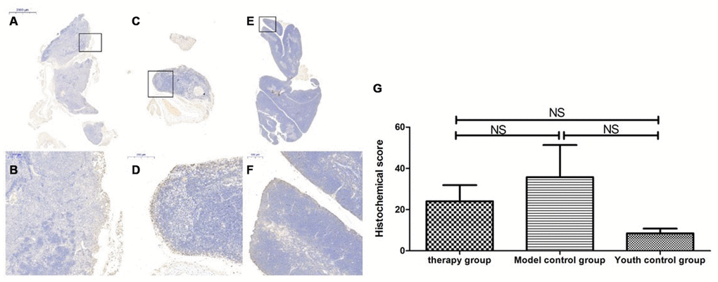 Changes in p16 expression in the mouse thymus after treatment with mUCMSCs. Note: (A, B) show P16 immunohistochemical staining of thymus tissue in the treatment group after treatment for 1 month. The expression of p16 protein in the thymus of the treatment group was increased. (C, D) show P16 immunohistochemical staining of mouse thymus tissue in the model control group. (E, F) show immunohistochemical staining of thymus P16 in young control mice. (G) shows the difference in P16 expression in mouse thymus tissue between different groups after mUCMSC treatment. All dark brown tissue sections were strongly positive, brownish-yellow staining was moderately positive, light yellow staining was weakly positive, and blue nuclei were negative. Note *** indicates p  0.05.