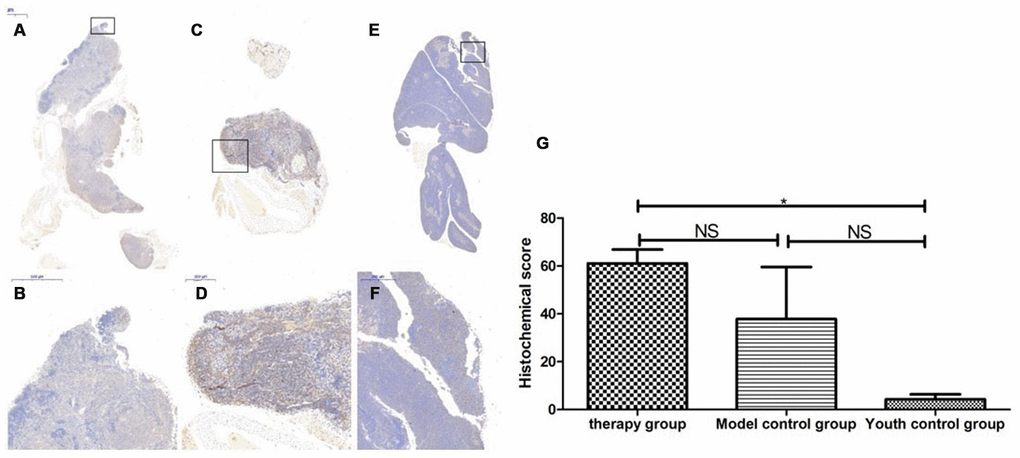 SOD expression level in the mouse thymus after treatment with mUCMSCs. Note: (A, B) show immunohistochemical staining of SOD in thymus tissue after treatment for 1 month in the treatment group. The levels of SOD1 were increased to different degrees in the treatment group. (C, D) show immunohistochemical staining of SOD in the mouse thymus tissue of the model control group. (E, F) show immunohistochemical staining of thymus SOD in young control mice. (G) shows the difference in SOD expression in mouse thymus tissue between different groups after mUCMSC treatment. All dark brown tissue sections were strongly positive, brownish-yellow staining was moderately positive, light yellow staining was weakly positive, and blue nuclei were negative. *** indicates p  0.05.