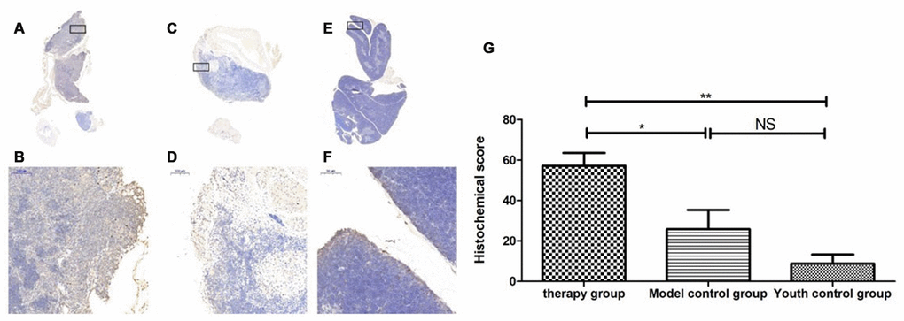 Expression of LC3 in the mouse thymus after treatment with mUCMSCs. Note: (A, B) show LC3 immunohistochemical staining of the thymus tissue after treatment in the treatment group. The levels of LC3 were increased to different degrees in the treatment group. (C, D) show LC3 immunohistochemical staining of the mouse thymus tissue in the model control group. (E, F) show immunohistochemical staining of thymus LC3 in young control mice. (G) Shows the difference in Lc3 expression in mouse thymus tissue between different groups after treatment with mUCMSCs. All dark brown tissue sections were strongly positive, brownish-yellow staining was moderately positive, light yellow staining was weakly positive, and blue nuclei were negative. *** indicates p  0.05.