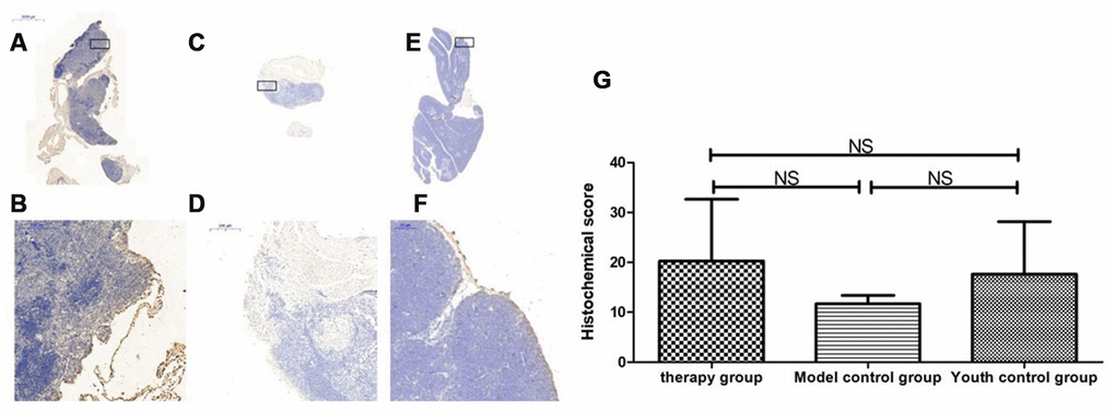 Expression of P62 in the thymus tissue of mice after mUCMSC treatment. Note: (A, B) show immunohistochemical staining of thymus P62 in young control mice. (C, D) show immunohistochemical staining of P62 in the thymus tissue after treatment for 1 month in the treatment group. (E, F) show immunohistochemical staining of P62 in the thymus tissue of model control mice. (G) shows the difference in P62 expression in mouse thymus tissue between different groups after mUCMSC treatment. All dark brown tissue sections were strongly positive, brownish-yellow staining was moderately positive, light yellow staining was weakly positive, and blue nuclei were negative. *** indicates p  0.05. The P62 activity in the model control group was the lowest, and the P62 activity in the treatment group was the highest.