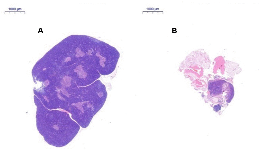 Changes in the thymus tissue structure in C57 mice of different ages. Note: (A) shows the thymus from a 2-month-old C57 mouse (20×); (B) shows the thymus from an 18-month-old C57 mouse (20×). HE staining of the thymus in 18-month-old C57 mice: the volume of the thymus was reduced, and the boundary of the cortex and medulla was not clear; most of the thymus tissue had been replaced by adipose tissue.