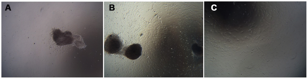 Cell growth morphology (100×). Note: (A) shows the first day of primary culture, as the cells migrate from the umbilical cord tissue. (B) shows the sixth day of primary culture, and the cells that grew were observed around the umbilical cord tissue. (C) is a cell from the P3 generation.