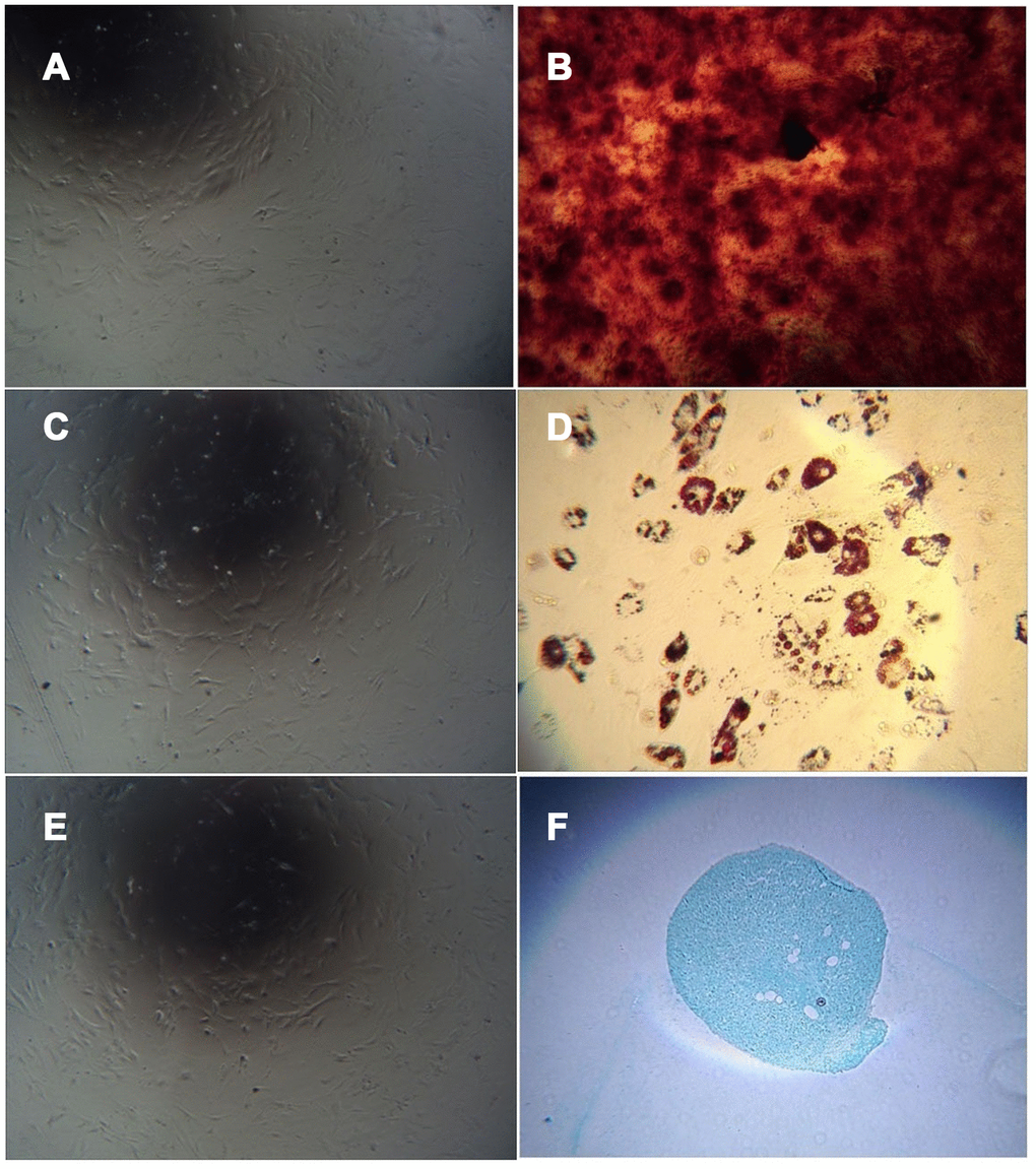 Cell differentiation induced by adherent culture of C57 mouse umbilical cord tissue. Note: (A) Adherent cells from C57 mouse umbilical cord tissue cultured in mesenchymal medium as a control group; (B) Adherent cells from C57 mouse umbilical cord tissue cultured with osteogenic induction of calcium nodules; (C) Uninduced cells are not stained; (D) Adherent cells from C57 mouse umbilical cord tissue with adipogenic induction after lipid droplets appeared; (E) Uninduced cells are not stained. (F) Adherent cells from C57 mouse umbilical cord tissue showing the cartilage collagen matrix after cartilage induction.