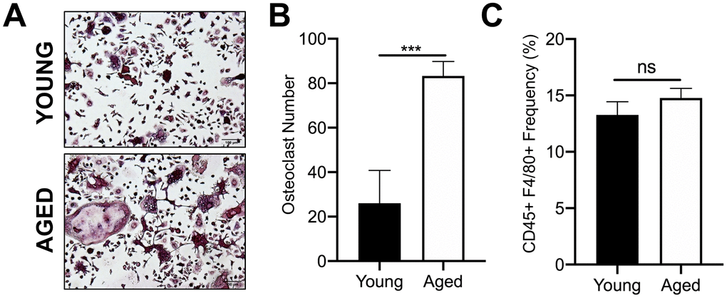 Aging increases OC formation from sorted CD45+F4/80+ bone marrow macrophages. Similar numbers of sorted CD45+F4/80+ macrophages from young and aged C57BL/6J mice were cultured in the presence of RANKL (80 ng/ml) and M-CSF (20 ng/ml). Growth media was changed every second day for 5-7 days until mature, multinucleated OCs (>3 nuclei) were formed. (A) Images of TRAP+ OCs generated. Scale bar is 100 μm. (B) The number of TRAP+ OCs formed in each well was quantified, showing that more OCs were generated from aged CD45+F4/80+ macrophages compared to young macrophages. Four independent experiments gave similar results, and a representative experiment is shown. Graphs are mean ± SD with ***p0.001 (N=4/group). (C) Frequency of CD45+F4/80+ macrophage (%) in bone marrow cells isolated from young and aged C57BL/6J mice (males and females combined). Data are mean ± SD of four independent experiments (p=0.08, ns indicates non-significant).