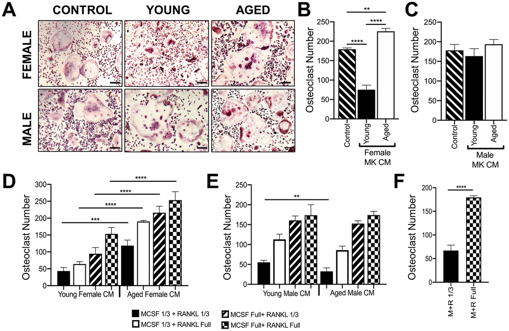 Effect of MK conditioned media on OC formation. (A–E) Conditioned medium (CM) was prepared from MKs isolated from young and aged, female and male mice. (A–C) Unsorted BMMs from mice (6-10 weeks) were cultured in media containing 25% (v/v) MK CM plus RANKL (80 ng/ml) and M-CSF (20 ng/ml). The control media was prepared without MKs. (A) Micrographs showing mature OCs. Scale bar is 50 μm. (B, C) The number of TRAP+ multinucleated OC (>3 nuclei) was quantified. The data show that MK CM from young female mice inhibits OC formation compared to control and aged female MK CM. The data are presented as mean ± SD of three experiments (****pD, E) Unsorted BMMs from mice (6-10 weeks) were differentiated into mature OCs in media containing 25% MK CM plus normal or reduced RANKL (80 or 26.6 ng/ml, respectively) and M-CSF (6.6 or 20 ng/ml, respectively). Mature OCs were fixed and TRAP+ OCs were counted. (F) Comparison of OCs formed in control media (no MK CM) with normal or reduced RANKL and M-CSF. Three independent experiments showed similar results and a representative figure is shown. The data are presented as mean ± SD (**ppp