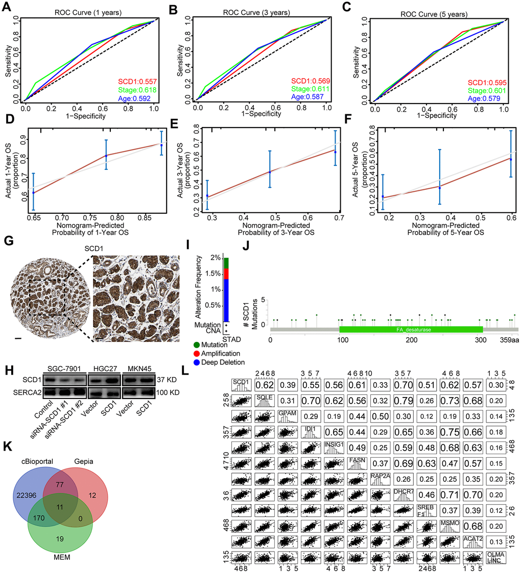 Bioinformatic analyses of SCD1. (A–C) Receiver operating characteristic (ROC) curve at 1, 3 and 5 years according to SCD1 gene expression in the TCGA-STAD database. (D–F) The calibration curve for predicting overall survival at 1-, 3- and 5-years in the TCGA-STAD database. (G) Representative images from gastric cancer tissue stained with SCD1, the scale bar, 100 μm and 50 μm, respectively. (H) Endoplasmic reticulum of gastric cancer cells were isolated, proteins were separated by SDS-PAGE and evaluated by immunoblots. (I) The alteration frequency of SCD1 were determined by using the cBioportal. (J) Screenshot of SCD1 mutation frequencies. (K) The Venn diagram illustrated the common correlated factors of SCD1 identified via cBioportal, Gepia and MEM analysis tools. (L) The correlations between SCD1 and correlated factors mRNA expression levels in human gastric cancer tissues (TCGA, n=375).