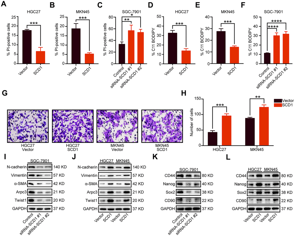 Oncogenic function of SCD1 in gastric cancer cells. (A–C) Gastric cancer cells were treated with 1 μM Erastin for 24 hours, then cell death was assessed using propidium iodide (PI), the bar plot represent quantification of PI-positive cells. Each experiment was conducted in triplicates. (D–F) C11-BODIPY staining of gastric cancer cells following treatment with 1 μM Erastin for 24 hours, the bar plot represent quantification of C11-BODIPY-positive cells. Each experiment was conducted in triplicates. (G, H) SCD1 ameliorated the migration ability of gastric cancer cells. (I, J) The metastatic related markers were analyzed by using western blotting with the indicated antibodies. (K, L) the cancer stemness related markers were analyzed by using western blotting with the indicated antibodies. GAPDH was used as the internal protein loading control. Each experiment was conducted in triplicates. *, P P P P 