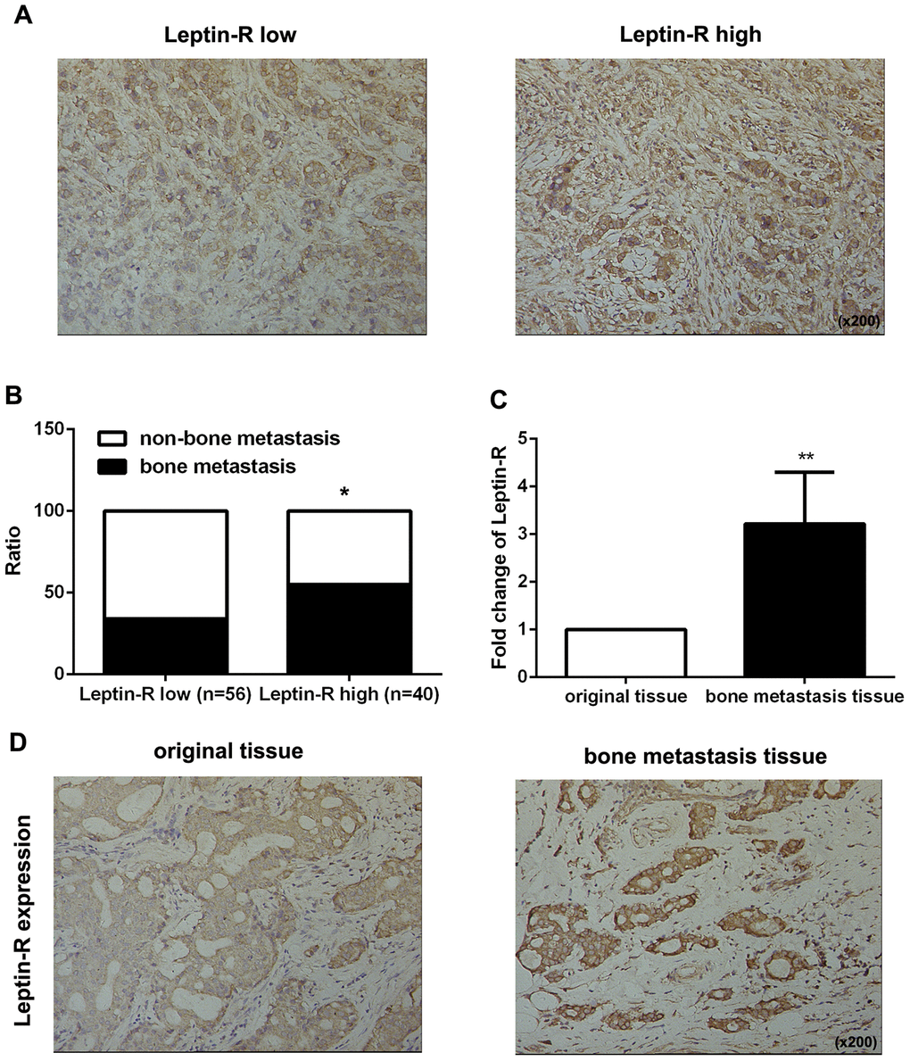 Leptin receptor expression was associated with malignancy and bone metastasis in breast cancer patients. (A) IHC staining was employed to examine leptin receptor expression in breast cancer tissues. (B) Frequencies of bone metastasis and non-bone metastasis in patients with low or high leptin receptor expression. (C) Realtime-PCR was used to measure leptin receptor expression in primary breast cancer tissue and bone metastasis tissue. The data are shown as means ± SD, **PD) IHC staining was employed to examine leptin receptor expression in primary breast cancer tissue and bone metastasis tissue.