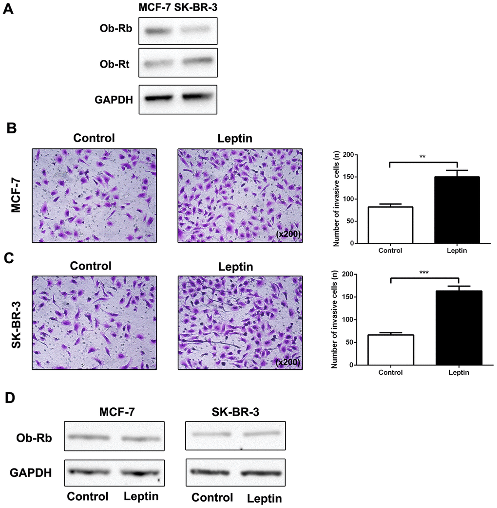 Leptin promoted breast cancer cell metastasis and leptin receptor expression. (A) Western blot was used to detect Ob-Rb and Ob-Rt expression in MCF-7 and SK-BR-3 cells. (B, C) The effect of leptin on invasion of MCF-7 and SK-BR-3 cells was examined using the transwell assay. The upper and lower chambers of the wells were separated by polycarbonate membranes. Breast cancer cells (5×104/well) were seeded in the upper chambers of the 24-well plate with serum-free medium. The lower chamber was filled with medium containing 5% fetal bovine serum as a chemoattractant. The data are shown as means ± SD. **PD) Western blot was used to detect leptin receptor expression in MCF-7 and SK-BR-3 cells.