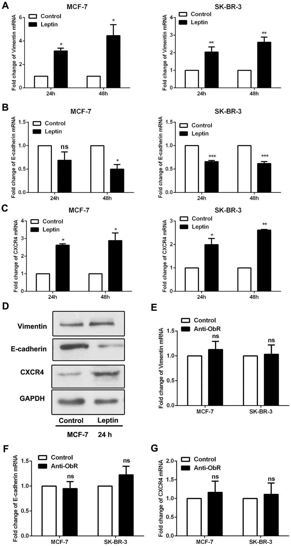 Leptin receptor mediated, leptin-induced EMT in breast cancer cells. (A–C) Real-time PCR was performed to examine Vimentin, E-cadherin, and CXCR4 expression in MCF-7 and SK-BR-3 cells. Data are shown as the means ± SD. *PPPD) Western blot was employed to detect Vimentin, E-cadherin, and CXCR4 expression in MCF-7 cells. (E–G) Real-time PCR was used to detect Vimentin, E-cadherin, and CXCR4 expression in MCF-7 and SK-BR-3 cells. Data are shown as means ± SD. ns, not significant.