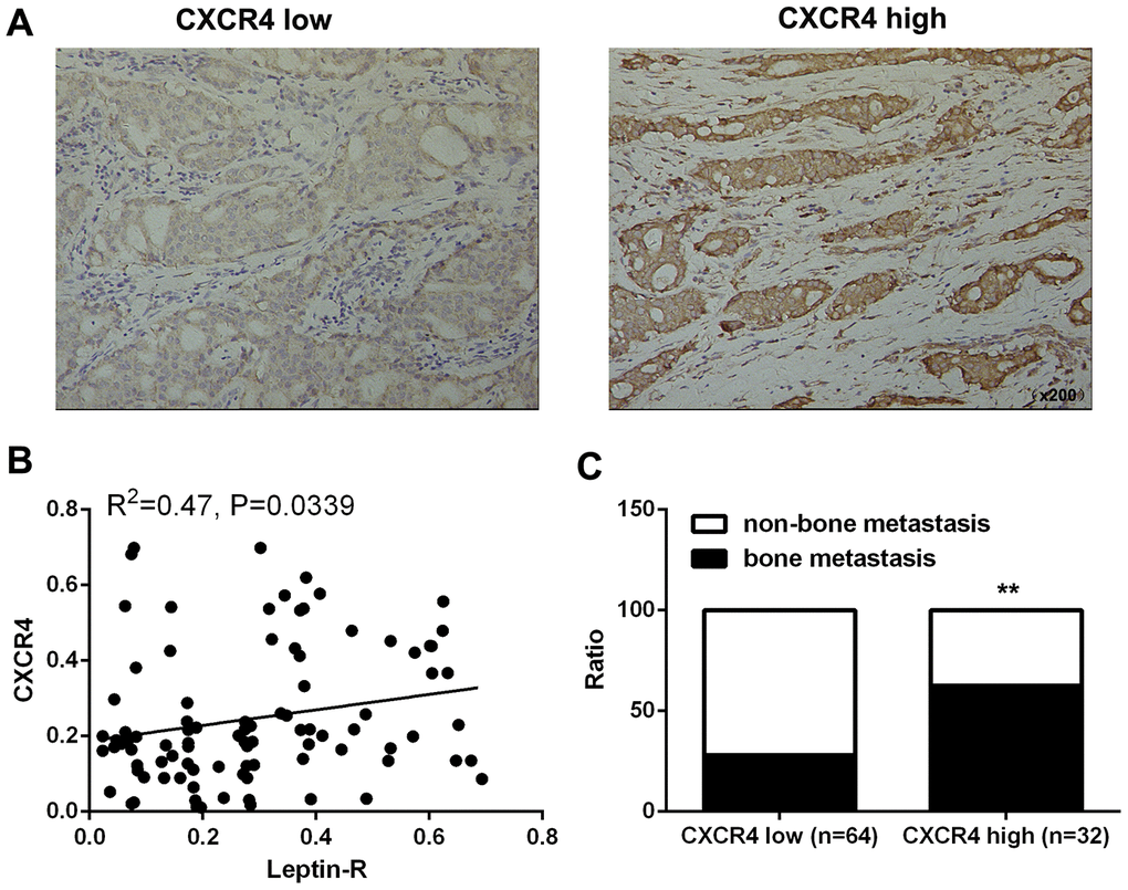 High CXCR4 expression promoted bone metastasis of breast cancer. (A) IHC staining was employed to examine CXCR4 expression in breast cancer tissues. (B) Integrated optical density (IOD) analysis indicated that Leptin receptor and CXCR4 expression were positively correlated in breast cancer patients. Pearson’s correlation analysis was used to determine the correlation coefficient (r) and p value. (C) Frequencies of bone metastasis and non-bone metastasis in patients with low or high CXCR4 expression.
