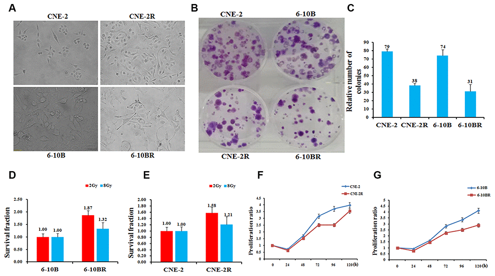 Establishment, identification and biological characteristics of radiotherapy resistant strains of nasopharyngeal cancer cells. (A) Cell morphology identification. CNE-2R and 6-10BR cell lines were established from CNE-2 and 6-10B, respectively. The cumulative dose of radiation of CNE-2R and 6-10BR reached to 80 and 76Gy, respectively. Under the optical microscope, the morphology of the cell line was obviously changed. (B and C) CNE-2R, 6-10BR and their parental cells were subjected to a sphere formation assay. The sphere numbers were determined after seven days for the first generation (G1) and seven days after seeding for G2. Treatment with SCF was repeated when the cells were passaged. The data are mean±SD of two independent experiments. (D and E) Radiosensitivity detection assay showed that the sensitivity of CNE-2R and 6-10BR cells was lower than that of parental cells. (F and G) Cell proliferation assay showed that the proliferation of CNE-2R and 6-10BR cells was slower than that of parental cells.