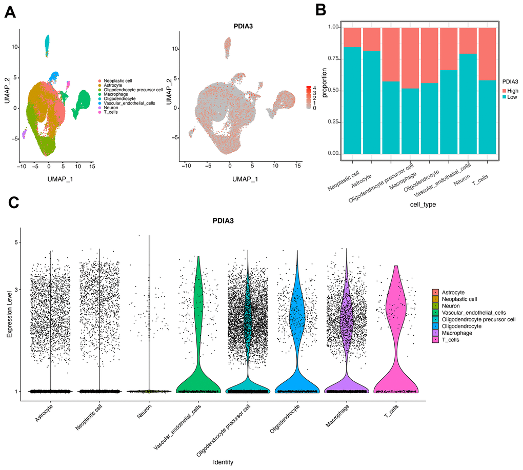 Identification of cell types in single cell sequencing analysis. (A) UMAP plot of tumor cells showing eight clusters with patient effects regressed out. Gray area represents the whole cell clusters. The red dot represents cell with PDIA3 expression. (B) The proportion of cells with PDIA3high or PDIA3low expression in eight cell clusters. (C) The expression level of PDIA3 in eight cell clusters.