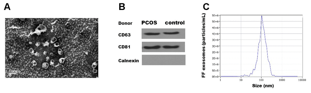 Characterization of exosomes isolated from human follicular fluid. (A). Transmission electron micrographs (TEM) of exosomes isolated from follicular fluid. Scale bar, 100 nm. (B) Immunoblots of positive exosomal markers (CD63, CD81) and negative marker (Calnexin) in representative follicular fluid exosomes. (C) The representative nanoparticle tracking analysis (NTA) profile of isolated exosomes.