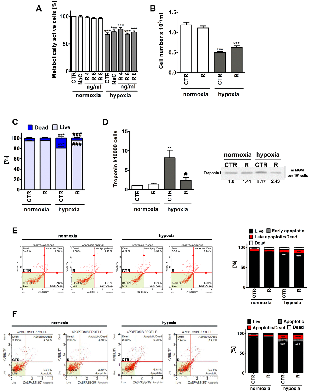 Remifentanil preconditioning-mediated effects on metabolic activity (A), cell number (B), the levels of necrotic cells (C), troponin I release, a marker of myocardial damage (D) and the levels of apoptotic cells (E, F) during normoxic and hypoxic conditions in human cardiac myocytes (HCM). (A) The metabolic activity was assayed using MTT test. Metabolic activity at control normoxic conditions (CTR) is considered as 100%. A solvent action (0.9% NaCl) is also shown. Based on MTT results, the concentration of 8 ng/ml remifentanil was selected for further analysis. Cell number (B) and necrotic cell death (C) were evaluated using TC10™ automated cell counter. (C) Necrosis was analyzed using trypan blue exclusion assay. (D) Western blot analysis of the levels of cardiac troponin I. Cardiac troponin I levels in supernatants (Myocyte Growth Medium, MGM) were calculated per 10000 cells. Two biomarkers of apoptotic cell death were considered, namely phosphatidylserine externalization (E) and the activity of caspase 3/7 (F) using Muse® Cell Analyzer and Muse® Annexin V and Dead Cell Assay Kit and Muse® Caspase-3/7 Assay Kit, respectively. Representative dot-plots are also shown. Bars indicate SD, n = 3, ***p **p *p ###p #p a posteriori test). CTR, control; R, remifentanil preconditioning.