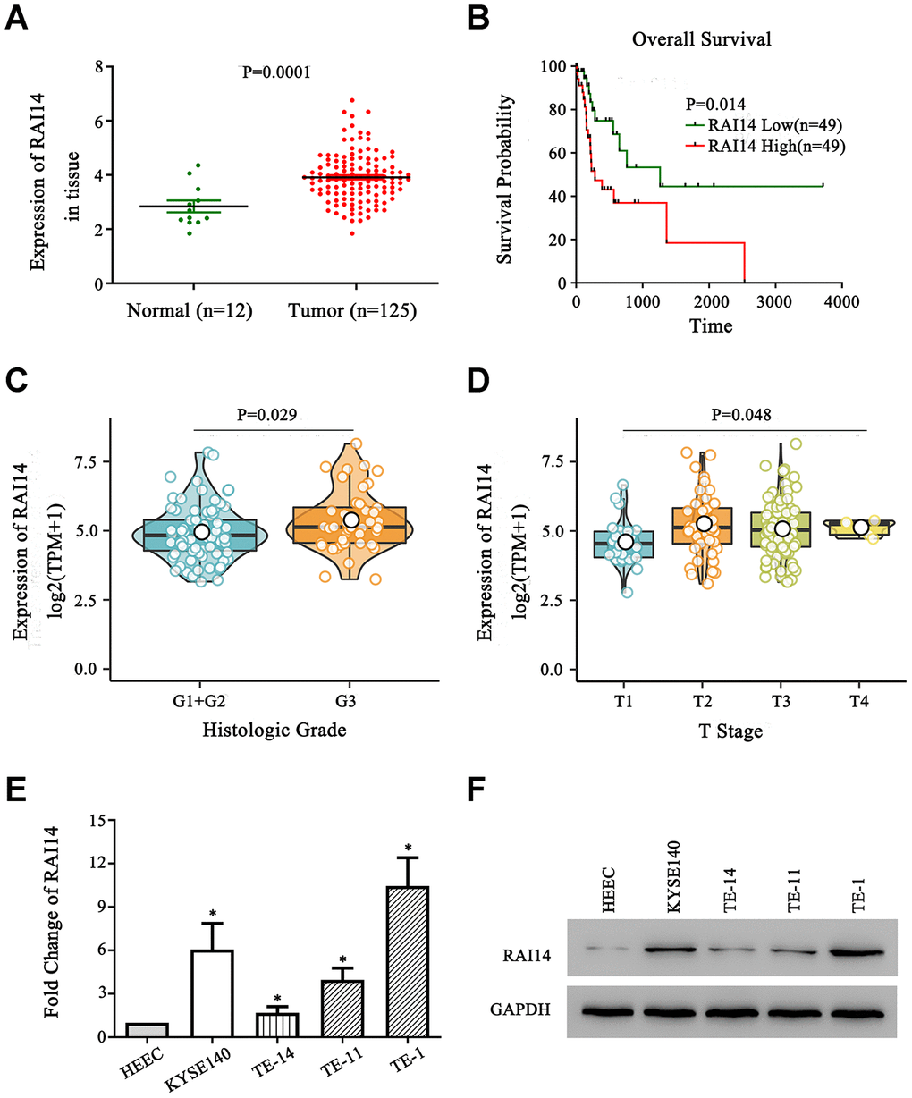 RAI14 is upregulated in EC. (A) The expression of RAI14 was upregulated in 125 esophageal tumor tissue samples (Tumor) as compared with that in 12 adjacent normal esophageal tissue samples (Normal) in TCGA. (B) Kaplan–Meier overall survival curves of EC patients stratified by high and low expression of RAI14. (C) The association between the expression of RAI14 and histologic grade. (D) The association between the expression of RAI14 and T stage. (E) qPCR analysis of RAI14 mRNA levels in EC cell lines and the esophageal epithelial cell line (HECC). (F) RAI14 protein levels in the EC cell lines and HECC line were determined by Western blotting. Average RAI14 mRNA and protein levels were normalized to the expression of GAPDH. Three independent experiments were conducted for each assay. *P 