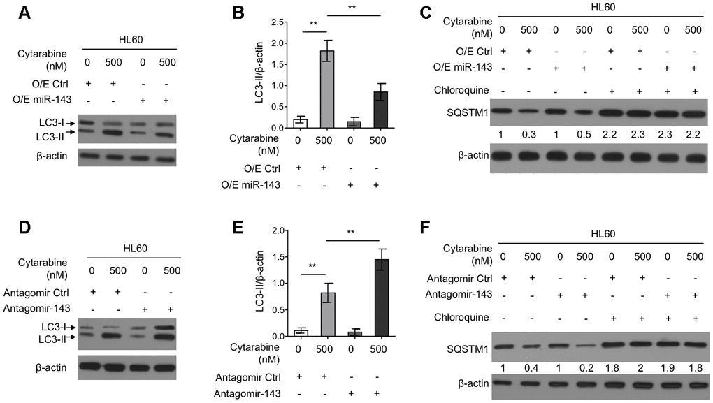 miR-143 inhibits cytarabine-induced autophagy in HL60 cells. (A, B) HL60 cells were transfected with 100 nM O/E miR-143 or 100 nM O/E Ctrl for 48 h, and then treated with or without 500 nM cytarabine for 24 h. The protein expression of LC-3 was measured by immunoblotting. β-actin was used as a loading control. The representative images (A) and statistical analysis of LC3-II/β-actin (B) are shown. (C) HL60 cells were transfected as in (A) and treated with cytarabine in the presence or absence of 30 μM chloroquine. The expression of SQSTM1 was analyzed by immunoblotting. (D, E) HL60 cells were transfected with 100 nM Antagomir-143 or 100 nM Antagomir Ctrl for 48 h, and then treated with or without 500 nM cytarabine for 24 h. The protein expression of LC-3 (D) and statistical analysis of LC3-II/β-actin (E) were conducted as in (A, B). (F) HL60 cells were transfected as in (D) and treated with cytarabine in the presence or absence of 30 μM chloroquine. The expression of SQSTM1 was analyzed by immunoblotting. All data were from 3 independent experiments and expressed as mean ± SD. Data were compared using Student t-test. **, P