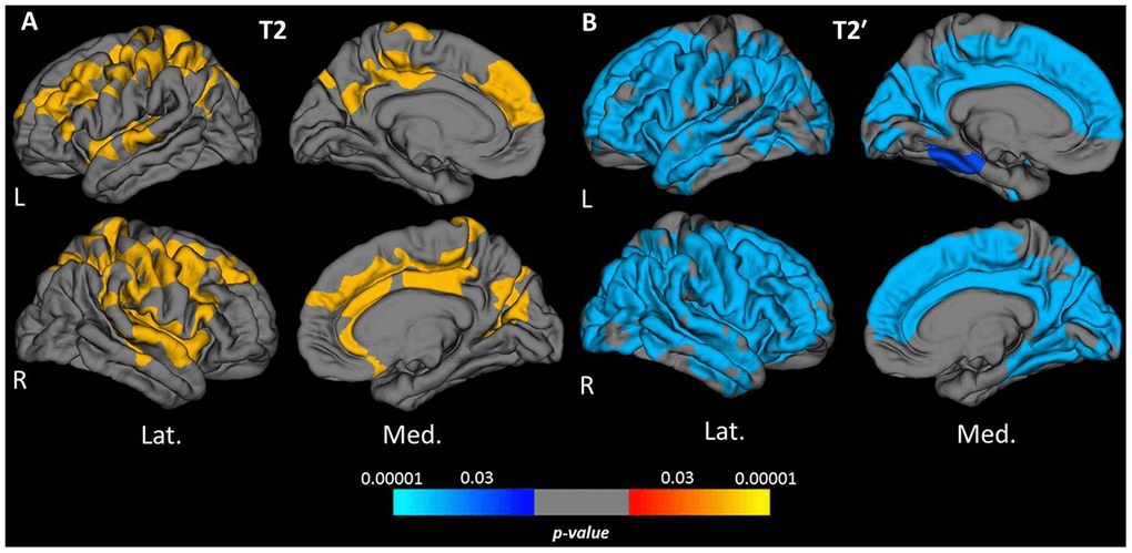 Cortical clusters exhibiting a significant relationship between age and cortical quantitative T2 (A) and T2′ values (B). The scale bar displays the level of significance. Hot colors demonstrate a positive and cold colors a negative association with age in the respective regions. L: left; R: right; Lat.: lateral; Med.: medial.