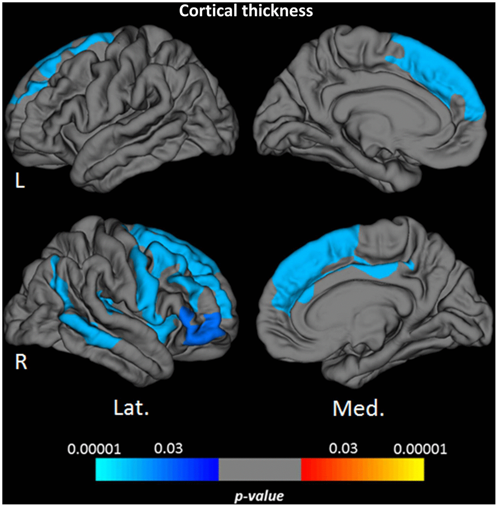 Cortical clusters indicating a significant relationship between age and cortical thickness. The scale bar indicates the level of significance. Cold colors demonstrate a negative association with age in the respective regions. L: left; R: right; Lat.: lateral; Med.: medial.