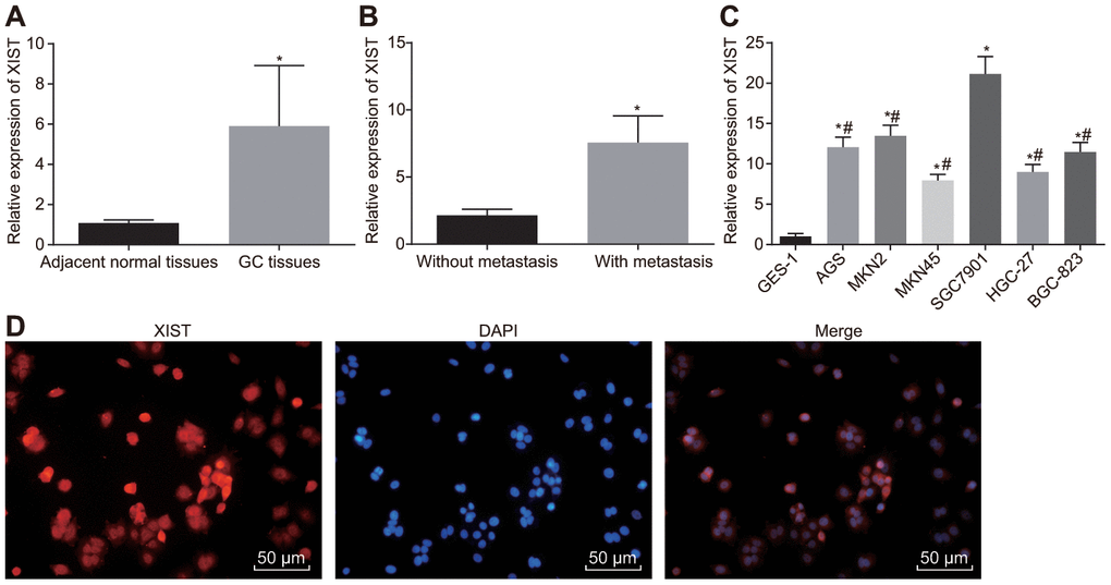 LncRNA XIST is highly expressed in gastric cancer tissues and cell lines. (A) Relative expression of lncRNA XIST in gastric cancer tissues (n = 65) and the adjacent normal tissues determined by RT-qPCR; *, p B) Relative expression of lncRNA XIST in gastric cancer tissues from patients with metastasis (n = 45) and without metastasis (n = 20) determined by RT-qPCR; *, p C) Relative expression of lncRNA XIST in different gastric cancer cell lines; *, p p D) the representative images of localization of lncRNA XIST merged with DAPI wherein red signal represented lncRNA XIST and blue signal represented cell nucleus (× 200). All measurement data and statistical results were expressed as mean ± standard deviation. Comparisons between two groups were analyzed by t-test, while comparisons among multiple groups were analyzed using one-way ANOVA. The experiment was repeated 3 times.