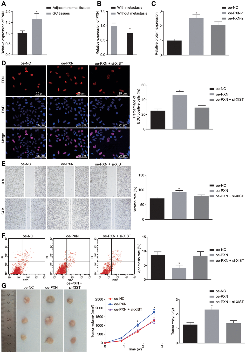 PXN enhances tumor formation ability, cell proliferation and metastasis, but suppresses cell apoptosis in gastric cancer. (A) Relative expression of PXN in gastric cancer tissues (n = 65) and the adjacent normal tissues determined by RT-qPCR; *, p B) Relative expression of PXN in gastric cancer tissues from patients with metastasis (n = 45) and without metastasis (n = 20) determined by RT-qPCR; *, p C–F), SGC7901 cells were transfected with oe-PXN or co-transfected with oe-PXN and si-XIST. (C) The mRNA expression of PXN detected by RT-qPCR; (D) Cell proliferation ability in each group detected by EdU assay (× 400); (E) Cell migration ability detected by scratch test (× 40); (F) Cell apoptosis ability detected by flow cytometry; (G) The effect of PXN and lncRNA XIST on tumor formation in nude mice injected with the stably transfected SGC7901 cells. All measurement data and statistical results were expressed as mean ± standard deviation. *, p 