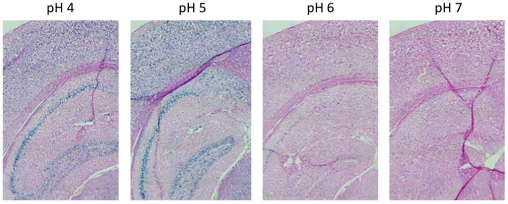 pH-dependent (pH 4 to pH 7) β-gal activity in frozen sections of 9 months old C57/Bl6J mice hippocampus. Nuclear Fast Red was used for counterstaining. At pH 6, specific for SA-β-gal, no marked β-gal activity is evident. Representative images from 3 different mice are shown.