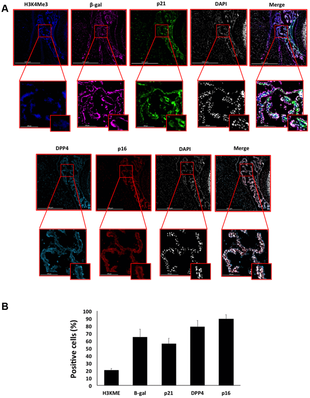 (A) Immunofluorescent staining of senescence markers of 9 months old C57/Bl6J mouse choroid plexus. Images display H3K4me3 (blue), β-gal (purple), p21 (green), DPP4 (cyan) p16 (red) and DAPI-stained nuclei (white) fluorescence signals. The corresponding multichannel overlaid images are shown in the right column. All these markers show an increased localization and expression in choroid plexus cells. Representative images from 3 different mice are shown. (B) Frequency of positive cells for each marker as in (A), indicated in %.