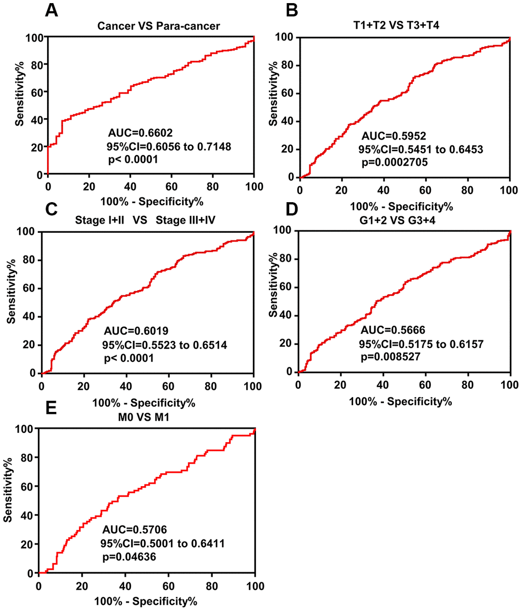 ROC curve analysis shows diagnostic significance of DAPK1 expression in ccRCC patients. (A) ROC curve analysis shows that DAPK1 expression accurately distinguishes ccRCC tissues from the corresponding normal kidney tissues with an AUC value of 0.6602 (95% CI: 0.6056 to 0.7148; pB–E) ROC curve analysis shows that DAPK1 expression distinguishes advanced- and early-stage ccRCC patients based on (B) T stages (T1+T2 vs. T3+T4), (C) pathologic Stages (I+II vs. III+IV), (D) G stages (G1+G2 vs. G3+G4), and (E) M stages (M0 vs. M1).
