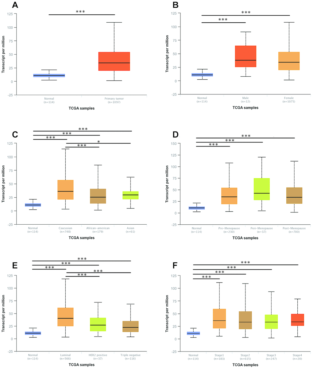 The mRNA expression of UNC5B in breast cancer patients with distinct clinicopathological features (UALCAN). (A) UNC5B mRNA expression in normal breast tissues and breast cancer tissues. (B) UNC5B mRNA expression in normal breast tissues and breast cancer tissues classified by gender. (C) UNC5B mRNA expression in normal breast tissues and breast cancer tissues classified by ethnicity. (D) UNC5B mRNA expression in normal breast tissues and breast cancer tissues classified by menopause status. (E) UNC5B mRNA expression in normal breast tissues and breast cancer tissues classified by molecular subtype. (F) UNC5B mRNA expression in normal breast tissues and breast cancer tissues classified by cancer stage. *, p p p 