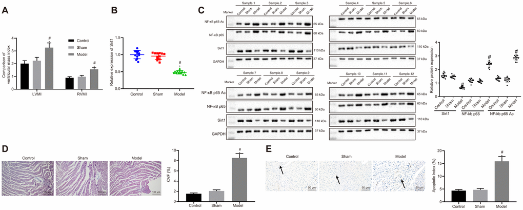 Sirt1, NF-κB p65 expression and apoptosis in heart tissues of successfully induced HF rats. (A) Ventricular mass index; (B) Sirt1 mRNA expression, determined using RT-qPCR; (C) Sirt1, NF-κB p65, and NF-κB p65 Ac protein expression assessed by Western blot analysis; (D) Collagen volume faction determined by Masson’s trichrome staining (100 ×); (E) Apoptosis determined by TUNEL staining (200 ×); *p p 
