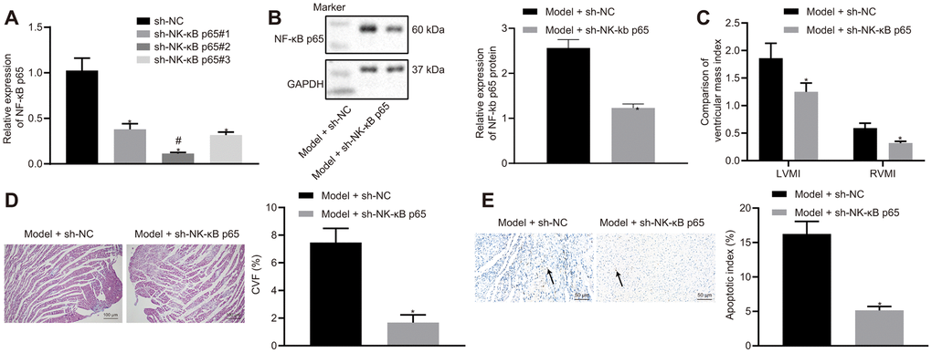 Effects of NF-κB p65 silencing on heart failure in rats. (A) NF-κB p65 mRNA expression after sh-RNA treatment; (B) NF-κB p65 protein expression in heart tissues; (C) Ventricular mass index; (D) CVF determined by Masson’s trichrome staining (100 ×); (E) Apoptosis determined by TUNEL staining (200 ×); *p 