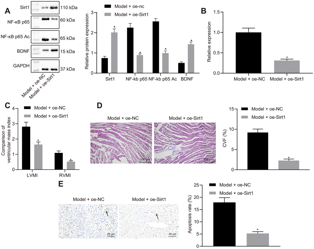 Effects of Sirt1 overexpression on heart failure in vivo. (A) Sirt1, NF-κB p65, NF-κB p65 Ac and BDNF protein expression; (B) miR-155 expression; (C) Ventricular mass index; (D) CVF determined by Masson’s trichrome staining (100 ×); (E) Apoptosis determined by TUNEL assay (200 ×); *p 