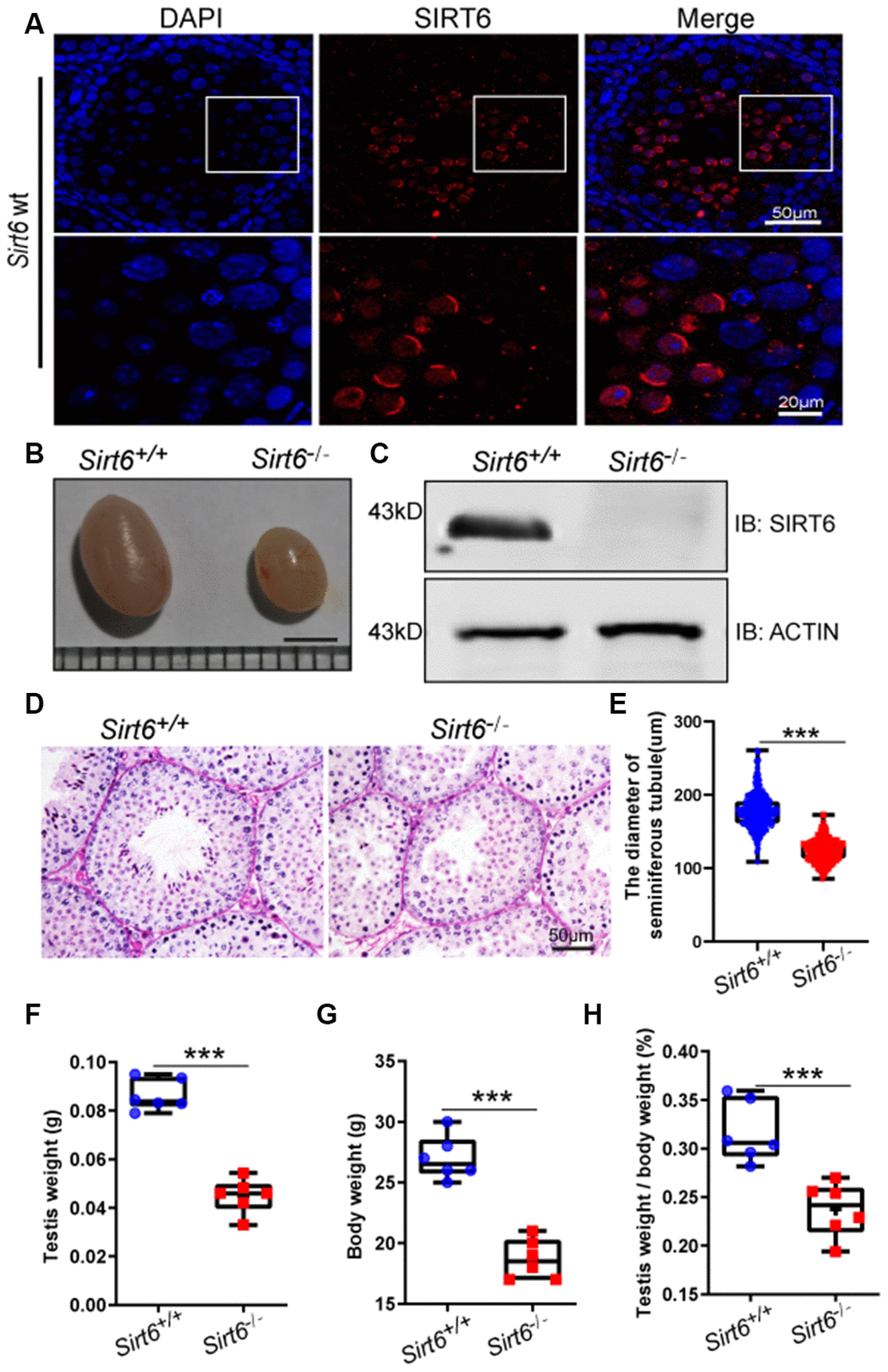 SIRT6 protein expression and localization in mice testes. (A) Testicular sections of Sirt6+/+ stained for SIRT6 (red) and DAPI (blue). SIRT6 is localized in the spermatids. 8-week mice, n=3. (B) The testes of Sirt6-/- mice were smaller than those of the Sirt6+/+ mice. 8-week mice, n=6, scale bar=3 mm. (C) SIRT6 protein levels were dramatically reduced in the testes of the Sirt6-/- mice. ACTIN was used as the loading control. 8-week mice, n=3. (D) Histological analysis of Sirt6+/+ and Sirt6-/- mice seminiferous tubules by PAS-hematoxylin staining. 8-week mice, n=4. (E) The diameter of the seminiferous tubules in Sirt6-/- mice was smaller than that in control mice. Sirt6+/+, 177.43±2.36μm; Sirt6-/-, 123.94±1.92μm. 8-week mice, n=6; 300 seminiferous tubules were used for each group. Data are presented as mean ± SEM. ***P F) Quantification of testis weight of the Sirt6+/+ and Sirt6-/- mice. The testis weight of Sirt6-/- mice was significantly reduced. Sirt6+/+, 8.60±1.30% g; Sirt6-/-, 4.49±1.40% g. 8-week mice, n=6. Data are presented as mean ± SEM. ***P G) Quantification of body weight of the Sirt6+/+ and Sirt6-/- mice. The body weight of Sirt6-/- mice was reduced. Sirt6+/+, 27.00±0.55 g; Sirt6-/-, 18.67±0.30g. 8-week mice, n=6. Data are presented as mean ± SEM. ***P H) The testis weight/ body weight of Sirt6-/- mice was also reduced. Sirt6+/+, 0.32±0.07%; Sirt6-/-, 0.04±0.07%. 8-week mice, n=6. Data are presented as mean ± SEM. ***P 