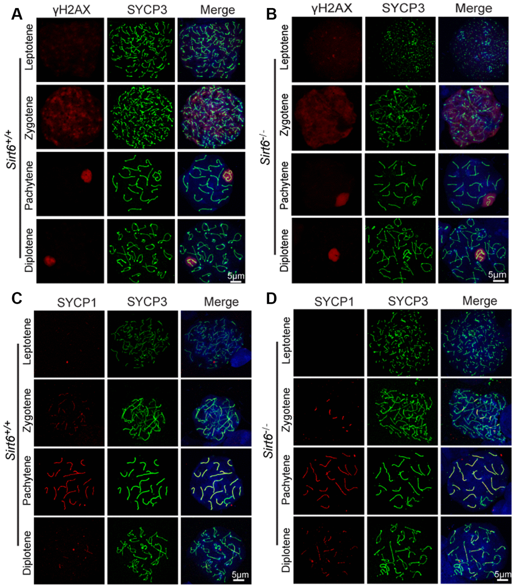 Sirt6 is not essential to meiosis during spermatogenesis. (A, B) Spermatocytes of Sirt6+/+ and Sirt6-/- stained with SYCP3 (green) and γH2AX (red) antibodies, 8-week mice, n=4; 200 cells were used for each group. (C, D) Spermatocytes of Sirt6+/+ and Sirt6-/- stained for SYCP3 (green) and SYCP1 (red), 8-week mice, n=4; 200 cells were used for each group.