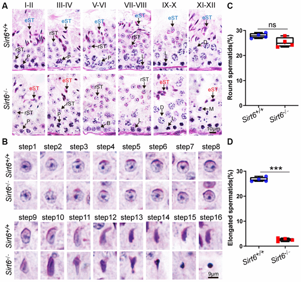 Sirt6 deficiency leads to spermatogenic arrest at the elongated spermatid stage. (A) Paraffin-embedded sections of seminiferous tubules and testes from Sirt6+/+ and Sirt6-/- were stained with PAS-hematoxylin. B, B type spermatogonial stem cells; L, leptotene spermatocytes; D, diplotene spermatocytes; P, pachytene spermatocytes; rST, round spermatids; eST, elongated spermatids; M, meiotic divisions. 8-week mice, n=4. (B) Different developmental steps of single round spermatid and elongated spermatids from Sirt6+/+ and Sirt6-/- testes. 8-week mice, n=4. (C) Quantification of the proportion of round spermatids in the Sirt6+/+ and Sirt6-/- mice. Sirt6+/+, 27.91±1.03%; Sirt6-/-, 25.27±1.96%. 8-week mice, n=4; 96 seminiferous tubules were used for each group. (D) Quantification of the proportion of elongated spermatids in the Sirt6+/+ and Sirt6-/- mice. Sirt6+/+, 26.67±0.48%; Sirt6-/-, 2.64±0.12%. 8-week mice, n=4; 96 seminiferous tubules were used for each group. Data are presented as mean ± SEM. ***P 