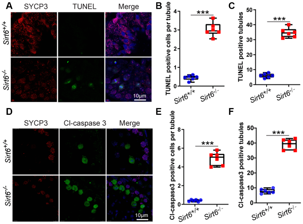 Sirt6 deficiency results in increased apoptotic spermatids. (A) Paraffin embedded sections from Sirt6+/+ and Sirt6-/- testes were stained with TUNEL kit (green) and SYCP3 (red) to determine the presence of apoptotic cells. 8-week mice, n=6. (B) Quantification of TUNEL positive cells per tubule of the Sirt6+/+ and Sirt6-/- mice. Sirt6+/+, 0.45±0.1; Sirt6-/-, 3.03±0.25. 8-week mice, n=6; 533 cells were used for each group. Data are presented as mean ± SEM. ***P C) Quantification of TUNEL positive tubules of the Sirt6+/+ and Sirt6-/- mice. Sirt6+/+, 6.00±0.49; Sirt6-/-, 34.67±0.53. 8-week mice, n=6; 228 seminiferous tubules were used for each group. Data are presented as mean ± SEM. ***P D) Paraffin embedded sections from Sirt6+/+ and Sirt6-/- testes were stained with Cl-caspase3 (green), SYCP3 (red) and DAPI (blue) to determine the presence of apoptotic cells. 8-week mice, n=6. (E) Quantification of Cl-caspase3 positive cells per tubule of the Sirt6+/+ and Sirt6-/- mice. Sirt6+/+, 0.40±0.13; Sirt6-/-, 4.88±0.34. 8-week mice, n=6; 497cells were used for each group. Data are presented as mean ± SEM. ***P F) Quantification of Cl-caspase3 positive tubules of the Sirt6+/+ and Sirt6-/- mice. Sirt6+/+, 7.83±0.50; Sirt6-/-, 39.00±0.59. 8-week mice, n=6; 201 seminiferous tubules were used for each group. Data are presented as mean ± SEM. ***P 