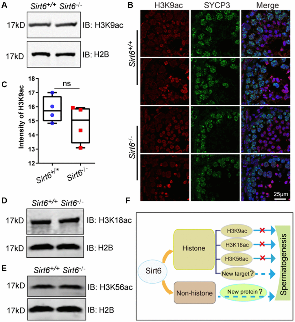 Deacetylation activity of SIRT6 on H3K9ac, H3K18ac and H3K56c is not required for spermatogenesis. (A) The levels of H3K9ac in Sirt6+/+ and Sirt6-/- testes were detected by western blot. 8-week mice, n=3. (B) Localization of H3K9ac in Sirt6+/+ and Sirt6-/- seminiferous tubules. Testes sections of Sirt6+/+ and Sirt6-/- stained with SYCP3 (green) and H3K9ac (red) antibodies. 8-week mice, n=4. (C) Quantification of H3K9ac intensity of round spermatids and elongated spermatids in the Sirt6+/+ and Sirt6-/- mice. Sirt6+/+, 15.82±0.48; Sirt6-/-, 14.78±0.58. 8-week mice, n=4; 200 cells were used for each group. Data are presented as mean ± SEM. (D) The levels of H3K18ac in Sirt6+/+ and Sirt6-/- testes were detected by western blot. 8-week mice, n=3. (E) The levels of H3K56ac in Sirt6+/+ and Sirt6-/- testes were detected by western blot. 8-week mice, n=3. (F) A functional diagram of Sirt6 in spermatogenesis.