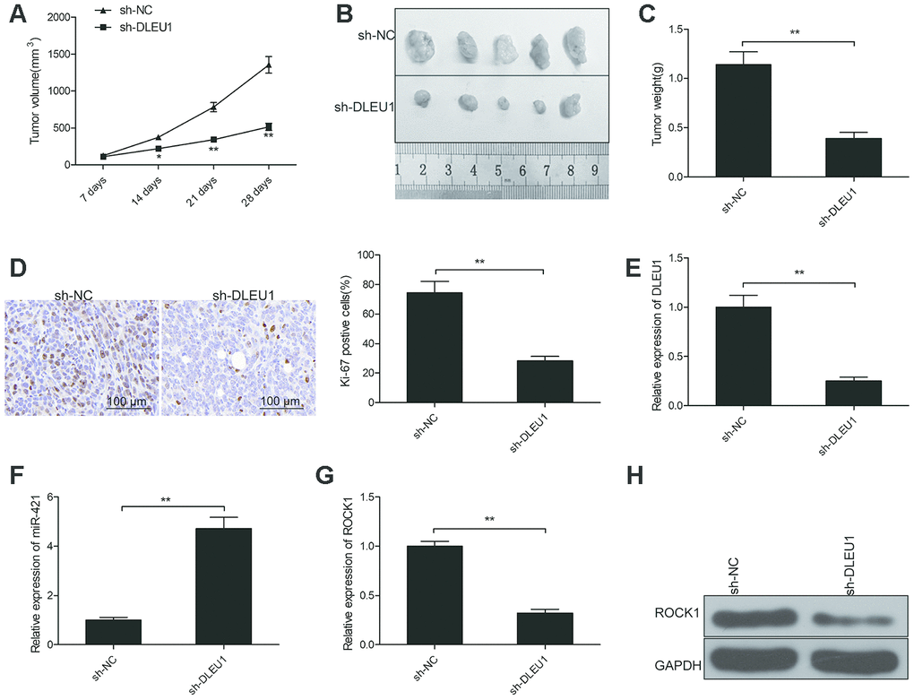 DLEU1 knockdown reduces in vivo growth of xenograft tumors in nude mice model. (A) The curve shows the rate of growth of xenograft tumors generated from subcutaneously injected control and DLEU1 knockdown TPC-1 cells in the nude mice (n=5 each). Tumor growth was measured every 7 days for 28 days. (B) The representative images show the xenograft tumors in nude mice that are subcutaneously injected with control and DLEU1 knockdown TPC-1 cells for 28 days. (C) The histogram plot shows the weight of xenograft tumors derived from nude mice subcutaneously injected with control and DLEU1 knockdown TPC-1 cells. (D) Representative images show IHC staining with the anti-Ki67 antibody of xenograft tumor tissue sections derived from nude mice subcutaneously injected with control and DLEU1 knockdown TPC-1 cells. (E–F) QRT-PCR analysis shows the levels of DLEU1 and miR-421 in the xenograft tumor tissues derived from nude mice subcutaneously injected with control and DLEU1 knockdown TPC-1 cells. (G) QRT-PCR analysis shows ROCK1 mRNA levels in the xenograft tumor tissues derived from nude mice subcutaneously injected with control and DLEU1 knockdown TPC-1 cells. (H) Western blot analysis shows ROCK1 protein levels in the xenograft tumor tissues derived from nude mice subcutaneously injected with control and DLEU1 knockdown TPC-1 cells. Note: The data are represented as the means ± SD of at least three independent experiments. *PP