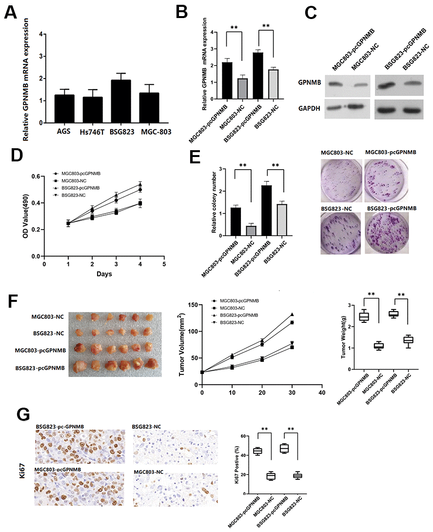 The GPNMB expression in different STAD cells. (A) The expression efficiency of pc-GPNMB was measured by RT-Qpcr (B) and WB assay (C) in MGC803 and BSG823 cells. MTT assays show that GPNMB overexpression increased cell proliferation in MGC803 and BSG823 cells (D). Colony formation assays indicate significantly increased the number of colonies in pc-GPNMB group (MGC803 and BSG823 cells) cells compared to NC group (E). The plots showing tumor growth measurements of MGC803-pc-GPNMB, MGC803 (control), BSG823- pc-GPNMB and BSG823 (control) cells is shown, and the mean tumor weights in each group (MGC803-pc-GPNMB, MGC803, BSG823-pc-GPNMB and BSG823) on day 30 is shown (F). IHC staining showing that cell proliferation (Ki67-positive) positively correlates with GPNMB expression levels (G). All the above experiments were repeated six times respectively. *P 