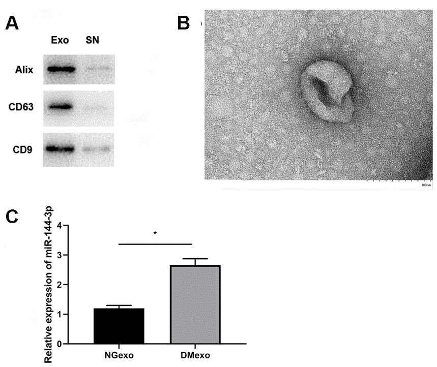 The expression of exosome marker (Alix, CD63, and CD9) in the exosome and supernatant fraction (A); the morphology of the diabetic exosome in TEM (B), scale bar 100 nm; the relative expression of miR-144-3p between NG-exo and DM-exo groups (C). N=3 for each group.