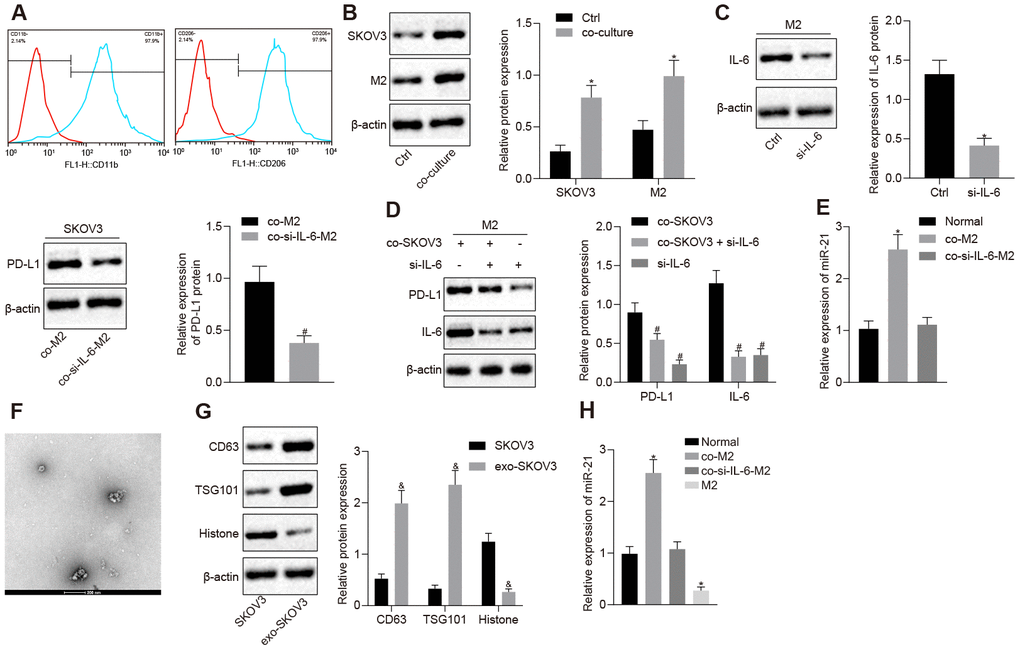 IL-6 from M2 macrophage elevates the expression of PD-L1 and miR-21 in ovarian cancer cells. (A) The markers of M2 macrophage, CD206 and CD11b, were measured by flow cytometry. (B) Protein level of PD-L1 after SKOV3 and M2 macrophage co-culture, in both cell types detected by western blotting. (C) The change of PD-L1 expression after SKOV3 co-culture with IL-6 depleted M2 macrophages was detected by western blotting. (D) The expression of PD-L1, IL-6 and PD-L1 were determined by Western blotting analysis. (E) The expression of miR-21 after SKOV3 co-cultured with IL-6 depleted M2 macrophages was determined by RT-qPCR. (F) Secretion of EVs was observed by TEM. (G) The markers for EVs isolated from SKOV3 were determined by Western blotting analysis. (H) The level of miR-21 in EVs isolated from SKOV3 co-cultured with IL-6 depleted M2 macrophages was assessed by RT- qPCR. * p vs. control or normal. # p vs. co-M2 or co-SKOV3. & p vs. SKOV3. Statistical comparisons were performed using unpaired t test when only two groups were compared or by Tukey’s test-corrected one-way ANOVA with when more than two groups were compared.