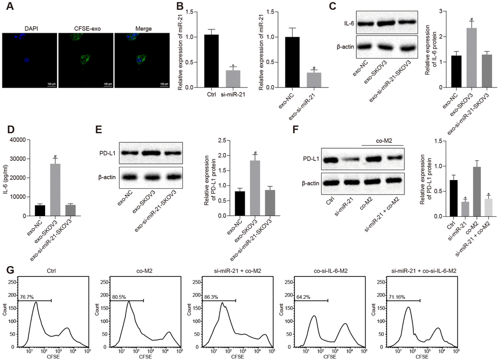 miR-21 secreted from ovarian cancer cells facilitates the secretion of IL-6 from M2 macrophages and this crosstalk elevates the expression of PD-L1 in both cell lines. (A) EVs uptake capacity of M2 macrophage visualized by CFSE-labeled EVs. (B) knock down efficiency of miR-21 assessed by RT-qPCR. (C) effect of miR-21 in EVs on the expression of IL-6 in M2 macrophage determined by Western blotting and RT-qPCR. (D) secretion of IL-6 by M2 macrophages was determined by ELISA assay. (E, F) expression of PD-L1 in M2 macrophage and SKOV3 determined by Western blotting analysis and RT-qPCR. (G) proliferation of CFSE-labeled T cells was assessed by flow cytometry. * p vs. control or co-M2. # p 0,05 vs. EVs-NC. Statistical comparisons were performed using unpaired t test when only two groups were compared or by Tukey’s test-corrected one-way ANOVA with when more than two groups were compared.