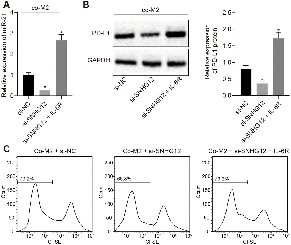 SNHG12 suppresses T cell proliferation by upregulation of PD-L1. (A) The expression of miR-21 determined by RT- qPCR. (B) protein levels of PD-L1 after SNHG12 depleted SKOV3 co-cultured with M2 macrophage determined by Western blotting analysis. (C) effect of SNHG12 depletion or IL-6R overexpression in SKOV3 co-cultured with M2 macrophages, on T cells proliferation determined by flow cytometry. * p vs. si-NC. Statistical comparisons were performed using unpaired t test when only two groups were compared or by Tukey’s test-corrected one-way ANOVA with when more than two groups were compared.