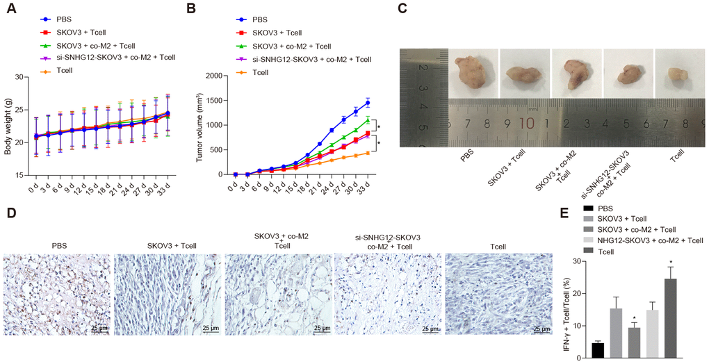 SNHG12 depletion suppresses immune escape in vivo. (A) Weight of mice recorded every 3 d. (B) Growth curve of transplanted tumor recorded every 5 d. (C) image of transplanted tumors (Scale = 1 mm). (D) CD3+ cells in transplanted tumors determined by IHC. (E) the rate of IFN-γ positive cells in transplanted tumors determined by flow cytometry. * p vs. SKOV3 + T cells. Statistical comparisons were performed using unpaired t test when only two groups were compared or by Tukey’s test-corrected one-way ANOVA with when more than two groups were compared. Variables were analyzed at different time points using Bonferroni-corrected repeated measures ANOVA.
