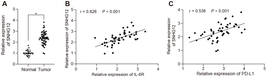 SNHG12 is highly expressed in clinical ovarian cancer patients and positively correlates with IL-6R. (A) the expression of SNHG12 in clinical ovarian cancer samples determined by RT-qPCR. (B) correlation between SNHG12 and IL-6 according to its ranks in related IHC results. (C) correlation of IL-6 and PD-L1 analyzed by IHC. Statistical comparisons were performed using unpaired t test. * p vs. normal tissue.