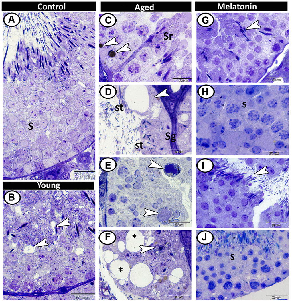 Semithin section of seminiferous tubules in the young and aged mice. (A) Different stages of spermatogenesis (S) in the control group. (B) In the young mutant mice, the presence of small vacuoles between the spermatogenic cells was observed (arrowheads). (C) The aged testis characterized by the presence of lipofuscin pigments (arrowheads) and Sertoli cells hypertrophy (Sr). (D) Vacuolation in Sertoli cells (arrowhead), many of seminiferous tubules only contained spermatogonia (Sg) and spermatids (St). (E) Multinucleated giant cells (arrowheads) were frequently demonstrated in the seminiferous tubules. (F) Some degenerated spermatogonia with pyknotic nuclei (arrowhead) were observed with vacuolated spermatogenic cells (asterisks). (G–J) In melatonin treated group, the seminiferous tubules showed normal spermatogenesis (S), and many mature sperms (arrowheads).