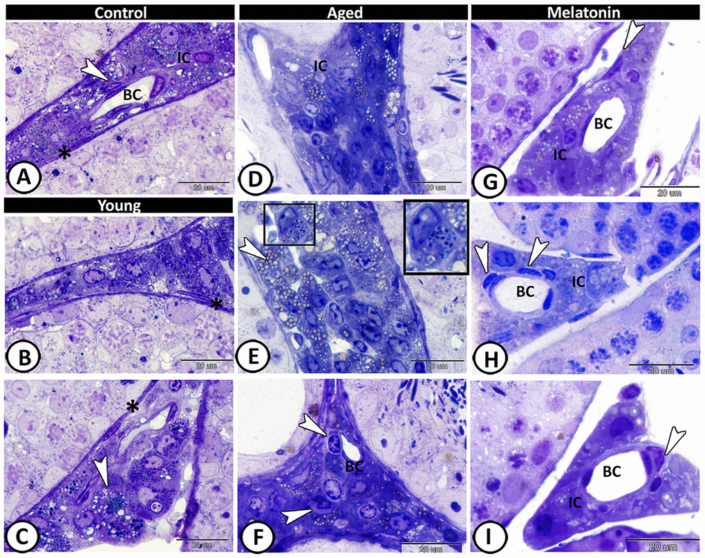 Semithin section of the interstitium in the young and aged mice. (A) In the control group, the interstitium contained Leydig cells (IC), myoid cells (asterisk), telocytes (arrowhead) and blood capillaries (BC). (B, C) The young mutant mice showed many lipid droplets in the Leydig cells (arrowhead), and normal myoid cells (asterisks). (D, E) Significant increase in the number of Leydig cells and their lipid droplets (arrowheads, IC) was detected in the aged mice. Note the presence of mast cells (boxed areas). (F) Dendritic reticular cells (arrowheads) were recorded around the blood capillaries (BC), among the affected interstitial cells (IC). (G–I) In melatonin group, the Leydig cells (IC) return to their normal number with widening in the lumen of blood capillaries (BC) and increase in the number of the telocytes (arrowheads).